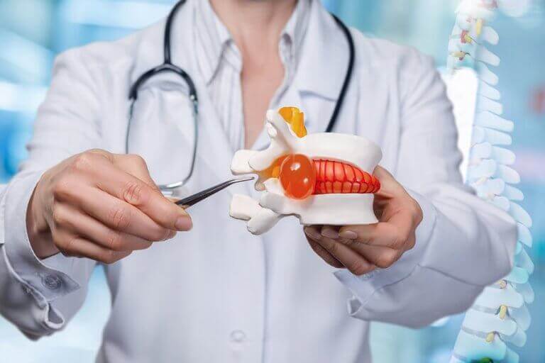 추간판 탈출증의 원인과 예방