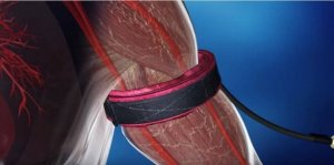 가압 훈련을 어떻게 시작할 수 있을까?